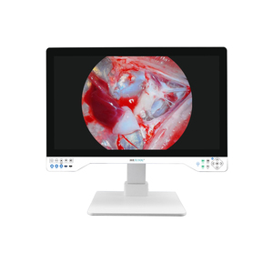TUYOU medicale ENT endoscopio macchina fotografica 4K UHD endoscopio portatile laparoscopia isteroscopio - Product Image 2