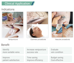 Alat Pencari Vena Medis Inframerah Portabel Genggam Perangkat Pencitraan Vena Peralatan Klinis - Product Image 5