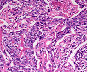 <span class=keywords><strong>Microscope</strong></span> biologique LCD numérique BLM2-241 BestScope caméra 6.0MP 11.6 pouces <span class=keywords><strong>Microscope</strong></span> biologique à fluorescence à écran Full HD - Product Image 5