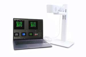 Alat pencitraan pembuluh darah, penampil Nadi definisi tinggi menampilkan sistem tampilan warna pencari pembuluh darah - Product Image 2