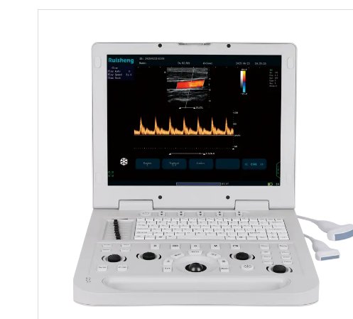 DYX High-end Portable Veterinary Ultrasound Doppler Machine Price for Animals