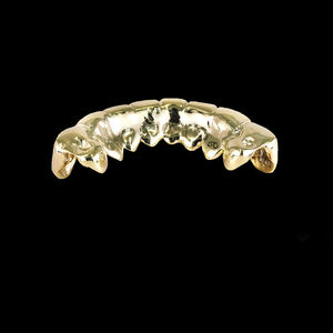 Ensemble de grillz personnalisé en or rose entièrement serti de diamants de style hip-hop avec diamants taille princesse pour les dents supérieures et inférieures - Product Image 3