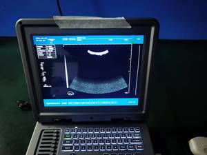 Giá Rẻ Giá trang trại sử dụng bác sĩ thú y máy siêu âm thiết bị di động thú y thiết bị siêu âm cho bò - Product Image 3