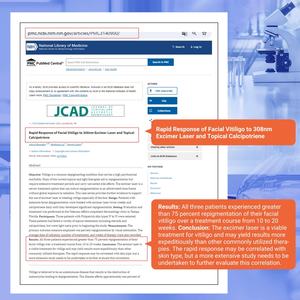 Dispositivo de Terapia de Luz Excimer de 308nm Avanzado y Dirigido ZJZK para el Tratamiento Profesional del Vitiligo, Máquina de Fototerapia UVB - Product Image 5