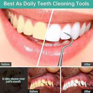 Nouveau Style 4PCS Kit de détartreur dentaire en acier inoxydable pour une élimination efficace de la plaque dentaire Meilleurs produits dentaires avec 2 ans de garantie - Product Image 4