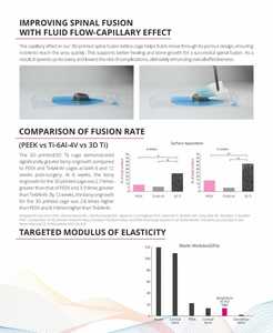 3D FLX PLIF FUSION CAGE-Instrumento quirúrgico de primera calidad para cirugía ortopédica - Product Image 5