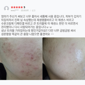 Trẻ cách trẻ cách Centella cica bản chất giá tốt nhất và sản phẩm tốt chất lượng cao và nóng bán - Product Image 3