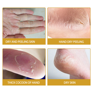 Crème pour les mains et les pieds Peut prévenir la sécheresse et les gerçures Fournit une hydratation et un blanchiment, et a également un effet lissant - Product Image 3
