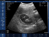 Ecógrafo de Bolsillo 3CL, Escáner de Ultrasonido Doppler de Mano, Doppler a Color, el Más Vendido para Uso Veterinario y Humano, Transductor Portátil