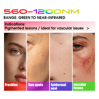 Appareil de luminothérapie BBL haut de gamme pour l'élimination des dommages cutanés, de la pigmentation, des taches de rousseur, des taches solaires et l'anti-âge