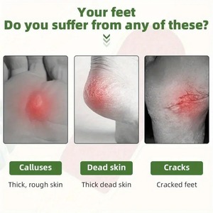 Lime à pied en bois professionnelle dissolvant de callosités épurateur de pied pédicure râpe à pied élimine l'épurateur de pédicure humide sec double face en bois - Product Image 5