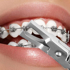 Meilleur pince à retirer les attaches orthodontiques, pince à retirer les attaches, pince à retirer les attaches orthodontiques, pince à retirer les attaches dentaires, 13 cm par SurgiRight - Product Image 4