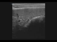 Sistema de Ultrasonido Doppler Color Veterinario Equino SonoScape X5V para Diagnóstico por Imágenes y Examen Reproductivo de Caballos