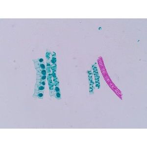 Lames de microscope préparées Spirogyra W.M. Conjugaison scalaire - Product Image 1