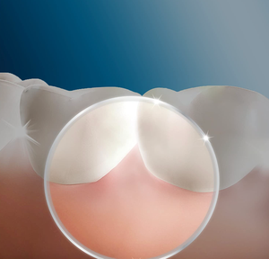 Oral-B Aqua Care ชุดเติมไหมขัดฟัน4ชิ้นทำจากประเทศเยอรมนี - Product Image 4