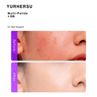 Sérum multi-peptides et acide hyaluronique à marque privée pour hydrater en profondeur, raffermir la peau et réduire les ridules pour une action anti-âge quotidienne