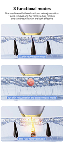 Nouvelle tendance 2025 Appareil IPL permanent pour usage domestique Épilateur <span class=keywords><strong>laser</strong></span> portable pour l'épilation avec refroidissement par glace Appareil de beauté - Product Image 5
