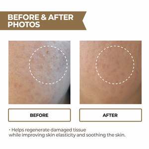 เซรั่ม PDRN RX ฟื้นฟูผิวหน้า บำรุงผิว ลดเลือนริ้วรอย และกระชับผิว - Product Image 3