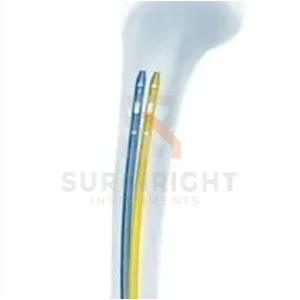 Instruments chirurgicaux orthopédiques manuels de haute qualité titane PFNA ongles intramédullaires système d'ongles de traumatisme par Surgiright - Product Image 4