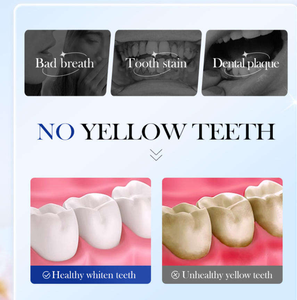 Dentifrice Nettoyant SADOER à l'<span class=keywords><strong>Enzyme</strong></span> de Fleur de Cerisier pour Blanchiment et Protection, Usage Domestique, Antibactérien Buccal, en Stock - Product Image 4