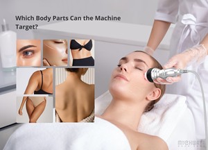 Máquina profesional de belleza en forma de S, máquina de salón de vacío para estiramiento de la piel - Product Image 5