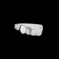 Custom Gold Solid Cap & Open Face Combo Único Hip Hop Diseño Tooth Grillz para los dientes superiores Boquilla de 2 dientes