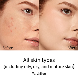 <span class=keywords><strong>Olio</strong></span> Viso Leggero Quotidiano OEM con Squalano e Acido Ialuronico - Formula Nutriente Anti-Età per Pelli Sensibili e Luminosità Naturale - Product Image 5