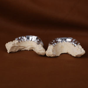 Exclusivo Moissanite Diamond Grillz Haz una declaración con Iced Out Bling para cualquier actuación - Product Image 4