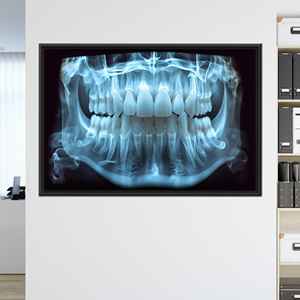 Impresión en lienzo de anatomía dental moderna: decoración artística de pared con rayos X dentales, 1P: con marco negro - Product Image 1