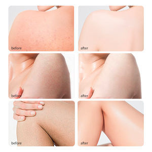 Bulk Supply Jamaican Black Castor Oil Hair Strengthening <b>Scalp</b> Nourishing Serum JAMAICAN BLACK CASTOR OIL for Hair Thinning - Product Image 2