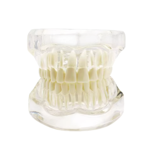 Hotseller NieuwBeijing TIANLIAN Transparant Anatomisch Tandmodel Prothese Implantaat Pathologisch Displaymodel - Product Image 6