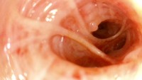 Équipement de bronchoscope vidéo portable vétérinaire endoscope vétérinaire flexible médical sans fibre pour animaux de compagnie cheval