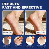 Lotion exfoliante pour les mains et les genoux, marque privée, crème à 60% d'urée pour les pieds, callosités, talons secs et fissurés