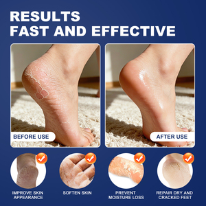 <span class=keywords><strong>Crema</strong></span> Esfoliante <span class=keywords><strong>per</strong></span> Mani e Ginocchia con Marchio Privato, 60% Urea, <span class=keywords><strong>per</strong></span> <span class=keywords><strong>Piedi</strong></span>, Calli, Talloni Secchi e Screpolati - Product Image 2