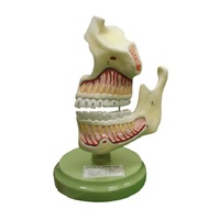 El modelo de mandíbula superior e inferior está agrandado, muestra la posición de los dientes y la mandíbula con sus raíces en el maxilar, 3 veces