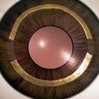 Trefine de Jacob Cairs pour kératoplastie et cornée, MARS INTERNATIONAL OPHTHALMIC