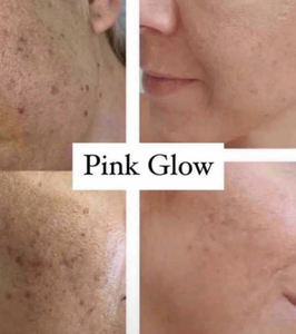 Booster Avanzato per la Cura della Pelle Sbiancante Coreano, per Professionisti della Cosmetologia, <span class=keywords><strong>Koru</strong></span> Pharma Mesoheal Pink Glow - Product Image 4