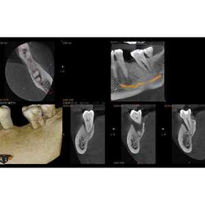 Appareil de radiographie panoramique numérique Carestream Dental CS8100, produit médical et esthétique - Product Image 2
