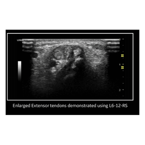 เครื่องอัลตราซาวด์ GE Versana Premier มือสอง - Product Image 3