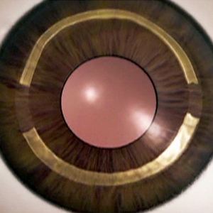 QUERATOPLASTIA OFTÁLMICA MARS INTERNATIONAL & CORNEA JACOB CAIRS TREPHINE .... - Product Image 6