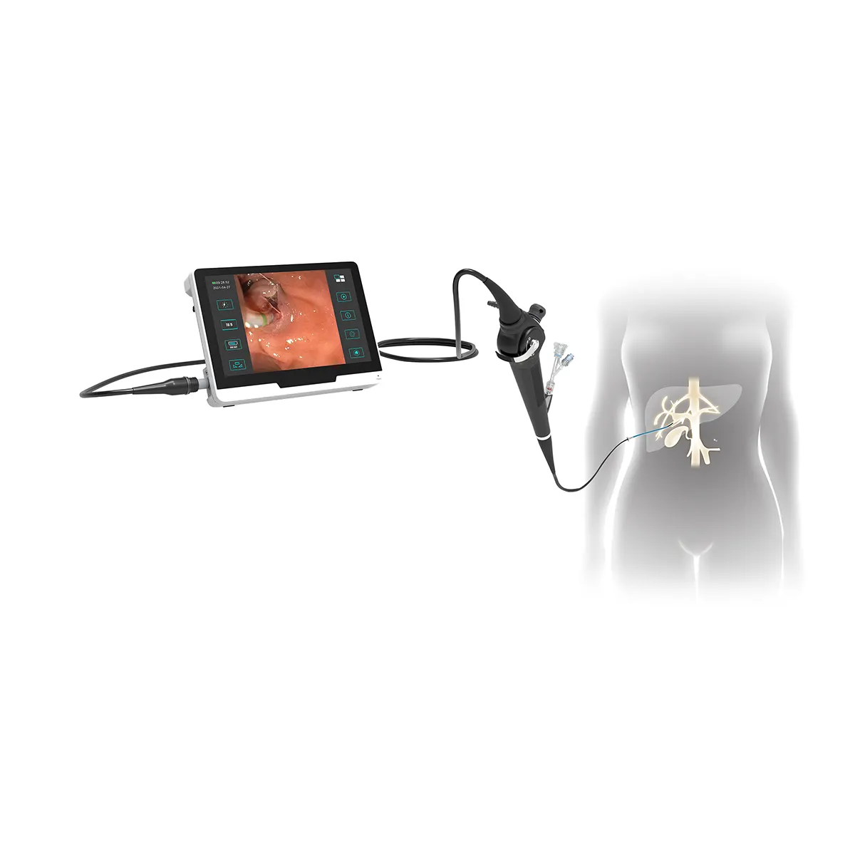 Endoscope choledochoscope vidéo flexible d'image HD pour équipement hospitalier de chirurgie PTCS à vendre