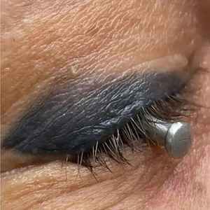 Protector Ocular Manual con Fuente de Alimentación, el Más Vendido del 2025, Juego de Instrumentos de Protección Láser, Acero Inoxidable Reutilizable, Certificado CE, 29 mm X - Product Image 6