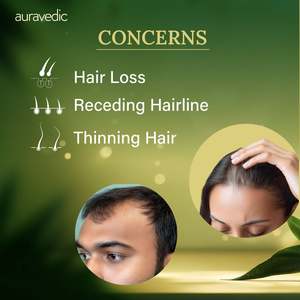 เซรั่มปลูกผมชนิดน้ำ แพ็ค 2 ขวด - Product Image 4