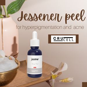 2025 nueva llegada Crucell Jessner Peel hiperpigmentación blanqueamiento de la piel mejor calidad 30mL exfoliación química auténtica ácido salicílico - Product Image 4