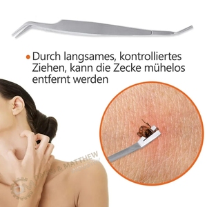 แหนบกำจัดเห็บสัตว์เลี้ยงทำจากสเตนเลสที่ปลายแหลมออกแบบมาสำหรับกำจัดเห็บสุนัขที่มีประสิทธิภาพ - Product Image 6