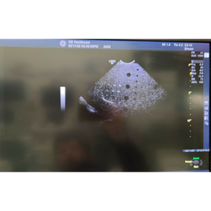 Nueva Sonda/Transductor de Ultrasonido Microconvexa GE C3-10-D XDClear OEM ODM Italia - Product Image 3