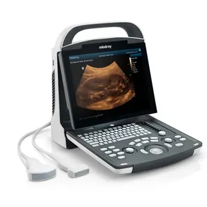 Mindray DP-20 DP-30 DP-50 Portable B/W Ultrasound Machine USG Digital Ultrasonic Imaging System for Human