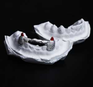 2023 à la mode unisexe luxe 10k or massif dents gril Provence personnalisable pierre principale diamant Fine Piercing bijoux personnalisé - Product Image 1