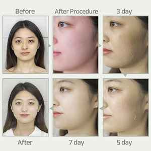 Kit de Suero Herbal para el Cuidado de la Piel Stavye Seanergy, Peeling Químico Líquido a Base de Glicerina para el Rostro, Exfoliante, Iluminador y Suavizante - Product Image 2