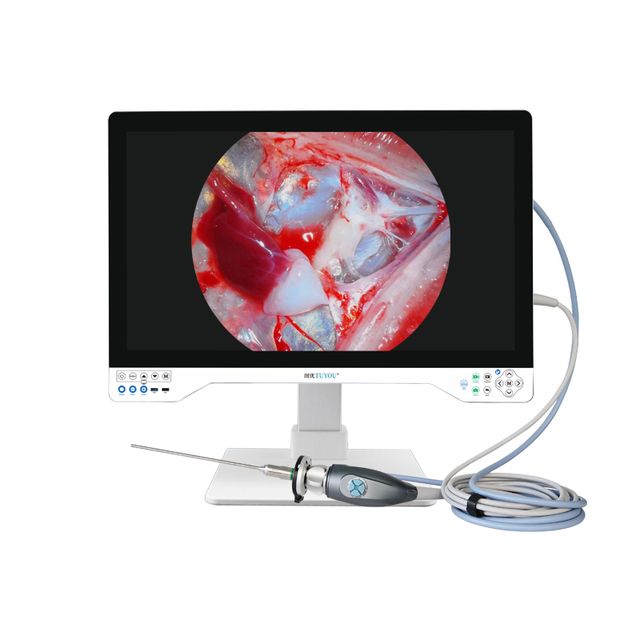 Tuyou Full Hd Medical Ent Endoscope Camera 4k Uhd Endoscope Unit Portable Laparoscopy Hysteroscope